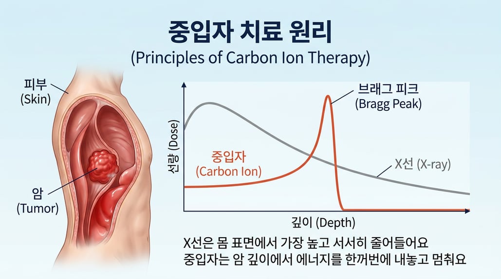 X선과 중입자의 깊이별 선량 곡선 비교