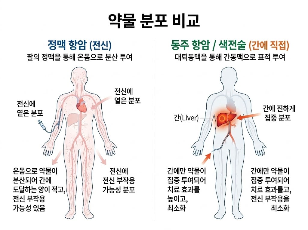 정맥 항암과 동주 요법의 약물 분포 비교