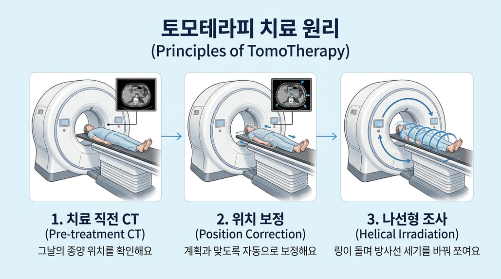 치료 직전 CT로 위치를 보정하고 링 장비가 나선형으로 돌며 조사하는 원리