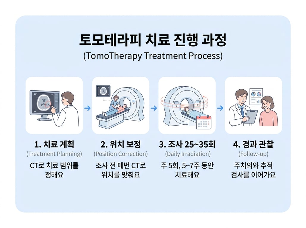 토모테라피 치료 진행 과정